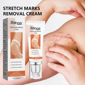 Eelhoe Crema para eliminar cicatrices para cicatrices viejas en las piernas Embarazo Crema para reparar cicatrices Crema Para eliminar estrías