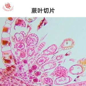 Fern leaf section showing sori, typical plant section, representative model of spore plants, <b>microscope</b> slide specimen. - Product Image 5