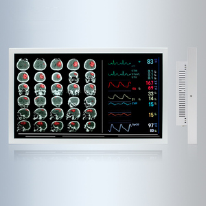 19 / <span class=keywords><strong>22</strong></span> / 24 / 27 32 inch New y tế cấp Màn hình 4K màu xám 8M dp HD <span class=keywords><strong>DVI</strong></span> SDI phẫu thuật nội soi y tế hiển thị màn hình - Product Image 3