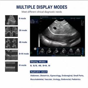 Meilleur prix - Appareil d'échographie Doppler couleur <span class=keywords><strong>3D</strong></span> portable BESTVET N60 pour hôpital vétérinaire - Product Image 3