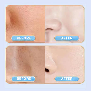 بيع بالجملة علامة خاصة أقنعة ورق الوجه الكورية الكولاجين فيتامين ج غرست الجلسرين المكونات القائمة على الترطيب العميق تبييض - Product Image 6