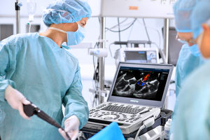 <span class=keywords><strong>Mindray</strong></span> <span class=keywords><strong>M9</strong></span> Echografieapparaat voor dierenartspraktijken, ziekenhuisapparatuur, medische apparatuur - Product Image 5