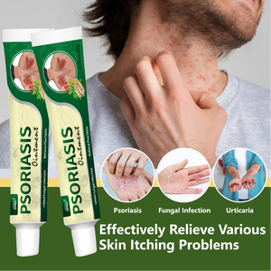 <span class=keywords><strong>Crème</strong></span> pour le <span class=keywords><strong>psoriasis</strong></span>, la dermatite et l'eczéma, pommade à base de plantes, anti-démangeaisons, antibactérienne, <span class=keywords><strong>crème</strong></span> de soin de la peau eczématoïde - Product Image 2