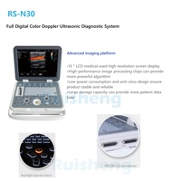 Échographe Doppler Couleur Portable RUISHENG N30 OB/GYN pour Diagnostic de Grossesse en Clinique et Hôpital