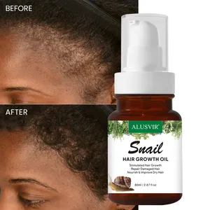 Customized Snail Hair Growth Oil Natural Hair Growth Products Fast Regrowth Repair Nourishing Hair Growth Oil For Men And Women