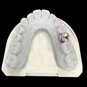 Prothèses dentaires et ponts métalliques de haute qualité <span class=keywords><strong>en</strong></span> forme de lustre métallique, laboratoire dentaire de Chine à bas <span class=keywords><strong>prix</strong></span> et de bonne qualité - Product Image 5