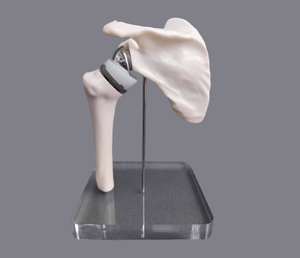 Modelo de Reemplazo de Articulación del Hombro - Modelo de Comunicación Médico-Paciente para Cirujanos Ortopédicos (Versión en Miniatura) - Product Image 2