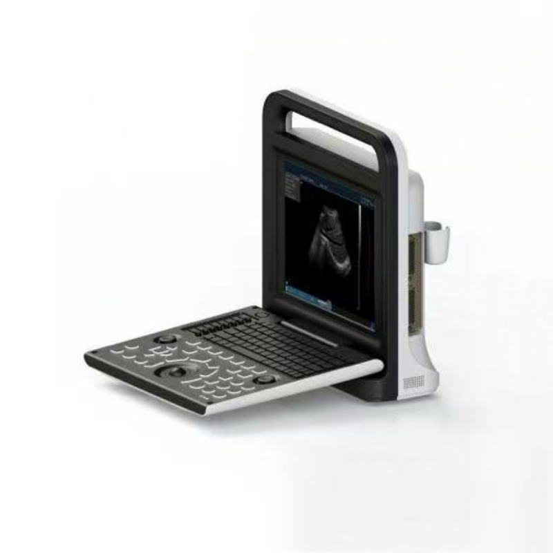 Color Dopplor Laptop Cardiac Ultrasound Color Dopplor Laptop Cardiac Ultrasound