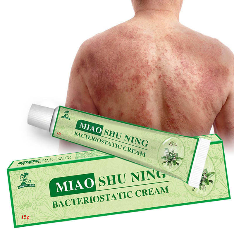 Wholesale Herbal Skin-soothing Ingredient Ointment for Psoriasis, Acne, Dermatitis, Scrotal Eczema, Pityriasis