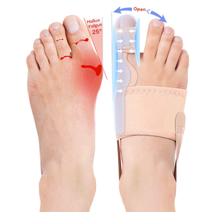 여성용 <span class=keywords><strong>Bunion</strong></span> 교정기 엄지 발가락 업그레이드 정형 <span class=keywords><strong>Bunion</strong></span> 부목/중괄호-외반 모지를위한 편안한 발 교정기 - Product Image 1