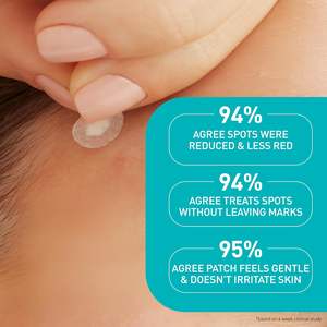 แผ่นแปะสิวไฮโดรคอลลอยด์ 100% รูปทรงกลม สำหรับรักษาสิวบนใบหน้า ด้วยเซราไมด์และไนอะซินาไมด์ เหมาะสำหรับทุกสภาพผิว - Product Image 3