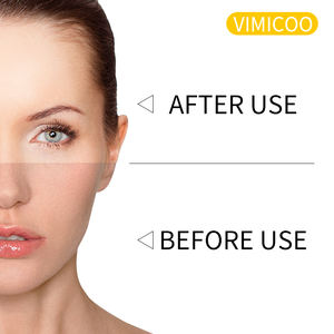 Logo disesuaikan grosir kulit kunyit bernutrisi menenangkan pelembab bintik hitam penghilang Jerawat Toner wajah semprot - Product Image 3