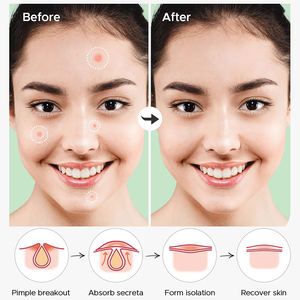 Forma personalizada Estrellas de colores Hidrocoloide Acné Imperfecciones Parches para espinillas Parches para el acné Etiqueta privada - Product Image 4