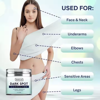 Meilleure crème blanchissante Crème correctrice pour l'élimination des points noirs Crème blanchissante pour les articulations des genoux foncés Crème blanchissante pour les aisselles