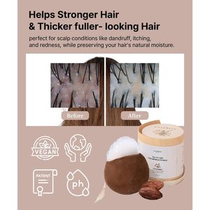 Erigeron All-in-One Cacao Mochi Shampoo Bar <strong>Scalp</strong> Care With Rosemary <strong>Oil</strong> Hair Growth Green Tea Dandruff Relief Itchy <strong>Scalp</strong> Free - Product Image 4