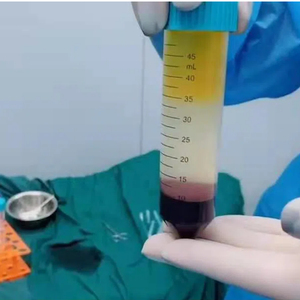 Tdl 5M Fabriek Prijs Gekoelde <span class=keywords><strong>Centrifuge</strong></span> 6000 Rpm 24X15Ml Vacuüm Buis Tafelblad Lage Snelheid <span class=keywords><strong>Centrifuge</strong></span> Laboratorium <span class=keywords><strong>Centrifuge</strong></span> - Product Image 6