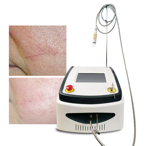 Tần số cao 980nm Diode <span class=keywords><strong>Laser</strong></span> Spider tĩnh mạch mạch máy loại bỏ vẻ đẹp mạch máu mao mạch thiết bị loại bỏ - Product Image 3