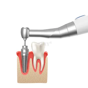 Elektrikli diş implant aracı evrensel implant tork anahtarı diş enstrüman implant protezi kaldırma kiti
