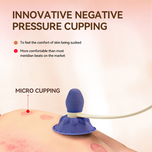 Nouvelle <span class=keywords><strong>ventouse</strong></span> multifonctionnelle sous vide pour l'application de tir méridien de bien-être corporel - Product Image 2