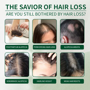 บำรุงหนังศีรษะอย่างล้ำลึก ฟื้นฟูรากผ<span class=keywords><strong>ม</strong></span> <span class=keywords><strong>เพิ</strong></span>่<span class=keywords><strong>ม</strong></span>ความหนาและเงางามของเ<span class=keywords><strong>ส</strong></span>้นผ<span class=keywords><strong>ม</strong></span> รองรับการสั่งซื้อขั้นต่ำจำนวนน้อยและการติดฉลาก<span class=keywords><strong>ส</strong></span>ินค้าภายใต้แบรนด์ของคุณเอง - Product Image 5