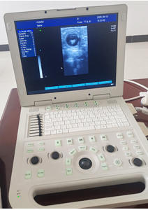 EUR VET 훌륭한 판매 수의학 장비 고급 디지털 휴대용 초음파 노트북 초음파 병원 용 - Product Image 5