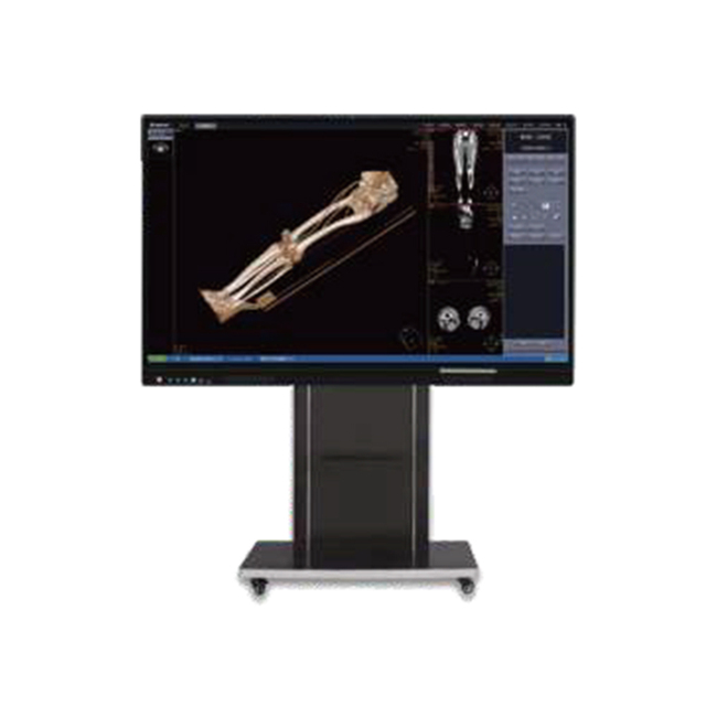 86" Intelligent Medical Imaging Comprehensive Consultation Display Center