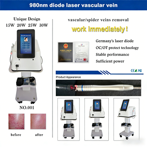 Dispositivo de Belleza con Diodo de 980nm para el Cuidado de la Rosácea y los Vasos Sanguíneos Rojos - Product Image 4