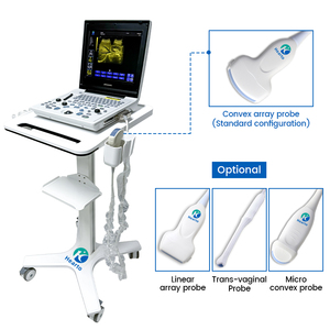 Sistema <span class=keywords><strong>de</strong></span> Diagnóstico por <span class=keywords><strong>Ultrasonido</strong></span> Completamente Digital en Blanco y Negro, Escáner <span class=keywords><strong>de</strong></span> <span class=keywords><strong>Ultrasonido</strong></span> B/N Hearto 120C con Pantalla LCD <span class=keywords><strong>de</strong></span> Alta Resolución <span class=keywords><strong>de</strong></span> 12 Pulgadas - Product Image 1