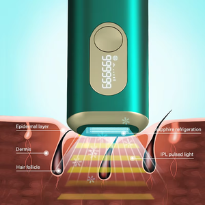 Cầm tay IPL-Laser vĩnh viễn tóc loại bỏ thiết bị ODM OEM thuốc làm rụng lông máy mini tóc loại bỏ thiết bị - Product Image 6