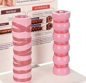 Modè<span class=keywords><strong>le</strong></span> anatomique de trachée humaine pour l'asthme <span class=keywords><strong>et</strong></span> les bronches, avec comparaisons normales <span class=keywords><strong>et</strong></span> pathologiques <span class=keywords><strong>et</strong></span> carte explicative (matériau PVC) - Product Image 4