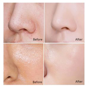 Savon exfoliant blanchissant anti-acné au lait de coco pour le corps, soin nettoyant pour adoucir et régénérer <span class=keywords><strong>la</strong></span> peau - Product Image 5