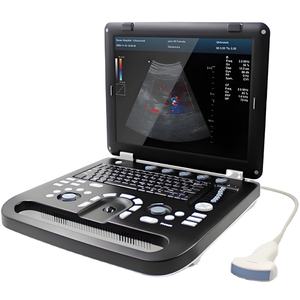 Peralatan sonografi medis sistem Ultrasound kompak dengan probe Array Linear, cembung, dan sewa - Product Image 1