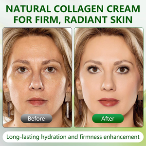 Crema de Colágeno en Gel con Extracto de Té Verde, Niacinamida y Colágeno Hidrolizado Liofilizado que Aumenta la Elasticidad de la Piel - Product Image 5