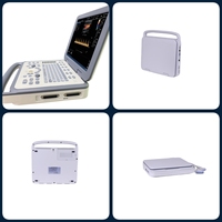 Échographe Doppler Couleur Portable RUISHENG N30 OB/GYN pour Diagnostic de Grossesse en Clinique et Hôpital
