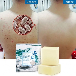 Jabón de leche de cabra hecho a mano para blanquear orgánico natural elimina el acné Limpieza facial profunda - Product Image 1