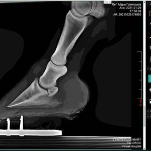 用于数字x光机MSLCV02的无线<span class=keywords><strong>DR</strong></span> MRI CR医用x射线平板探测器 - Product Image 6