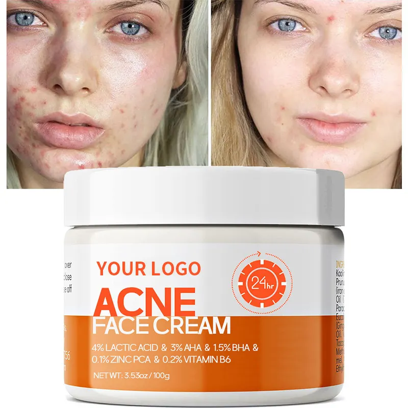 Crème coréenne personnalisée pour le traitement des boutons anti-acné et blanchissant pour le visage crème de soin de la peau anti-acné à base de plantes de marque privée pour le visage