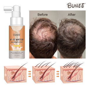 Muestras gratis agua de arroz crecimiento extremo rápido biotina crecimiento del cabello suero <span class=keywords><strong>spray</strong></span> para bordes rotos y cabello - Product Image 4