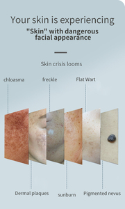 Nouvel appareil portable de suppression des taches, machine électrique, appareil de suppression des grains de beauté, stylo de suppression des tatouages de mélanine - Product Image 2