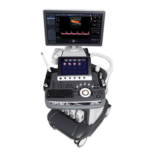 Chariot médical intelligent S50elite, appareil d'échographie 3D 4D avec fonction IA pour obstétrique et gynécologie, appareil d'échographie S50elite - Product Image 2