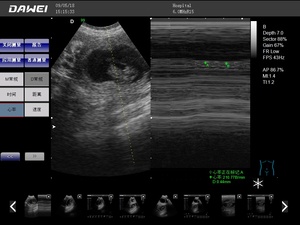 Dawei-Doppler de Color para uso veterinario, instrumento de ultrasonido portátil para clínica de mascotas - Product Image 4