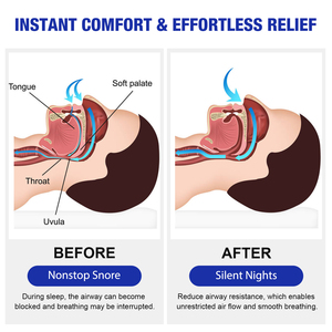 Sản phẩm xịt chống ngáy thảo dược tự nhiên SEFUDUN, thảo dược Trung Quốc, dùng ban đêm, giúp ngủ ngon hơn - Product Image 3