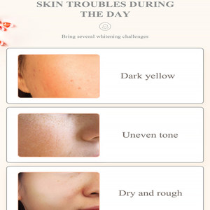 Crema de Día <span class=keywords><strong>Hidratante</strong></span> y Blanqueadora de Granada Roja Breylee, Repara la <span class=keywords><strong>Piel</strong></span> <span class=keywords><strong>Seca</strong></span>, Áspera y de Tono Amarillo Oscuro, la <span class=keywords><strong>Mejor</strong></span> Crema para el Rostro - Product Image 4