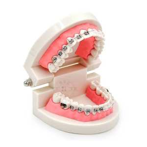 Modelo Dental de Ortodoncia, Brackets Semi-Cerámicos Semi-Metálicos, Implante de Plástico, Prótesis para la Comunicación Médico-Paciente y la Enseñanza - Product Image 3