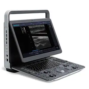 Sonoscape E1 Exp ultrasuoni medico 3d 4d portatile a colori Doppler macchina ad ultrasuoni