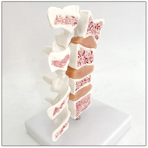 Modelo de osteoporosis de hueso humano Anatomía lumbar patológica Modelo de enseñanza de sección transversal espinal - Product Image 5