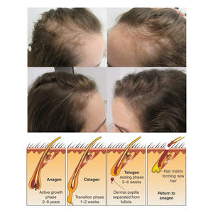 Crème Shampooing au <span class=keywords><strong>Riz</strong></span>, Extrait Herbal, Eau Vitaminée, Anti-chute, Nourrissant, Nettoyage en Profondeur, Favorise la <span class=keywords><strong>Croissance</strong></span> Capillaire, Flacon - Product Image 5