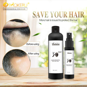 Balding สำหรับป้องกันผมร่วงและ30วันเร่ง Regrow เจริญเติบโตของเส้นผมโลชั่น - Product Image 5