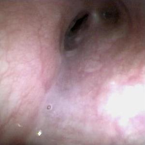 Vathin tek kullanımlık esnek veteriner endoskop bronkoskop tek kullanımlık Pet için esnek endoskop - Product Image 5