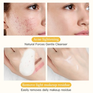 Mousse de limpieza facial calmante OEM al por mayor para pieles propensas al acné con espuma calmante, cúrcuma, lavado de cara suave - Product Image 2